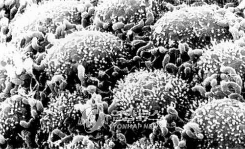 헬리코박터 파일로리균 [연합뉴스 자료 사진]